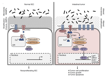 Figure 1. Barrier dysfunction and microbial regulation of epithelial tumor cells in CRC (Peuker et al., Nat. Med. 2016) 