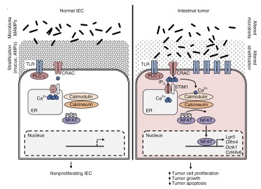 Figure 1. Barrier dysfunction and microbial regulation of epithelial tumor cells in CRC (Peuker et al., Nat. Med. 2016)